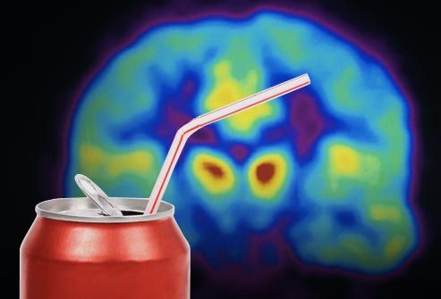 webmd_rm_photo_of_brain_scan_and__soda_can.jpg